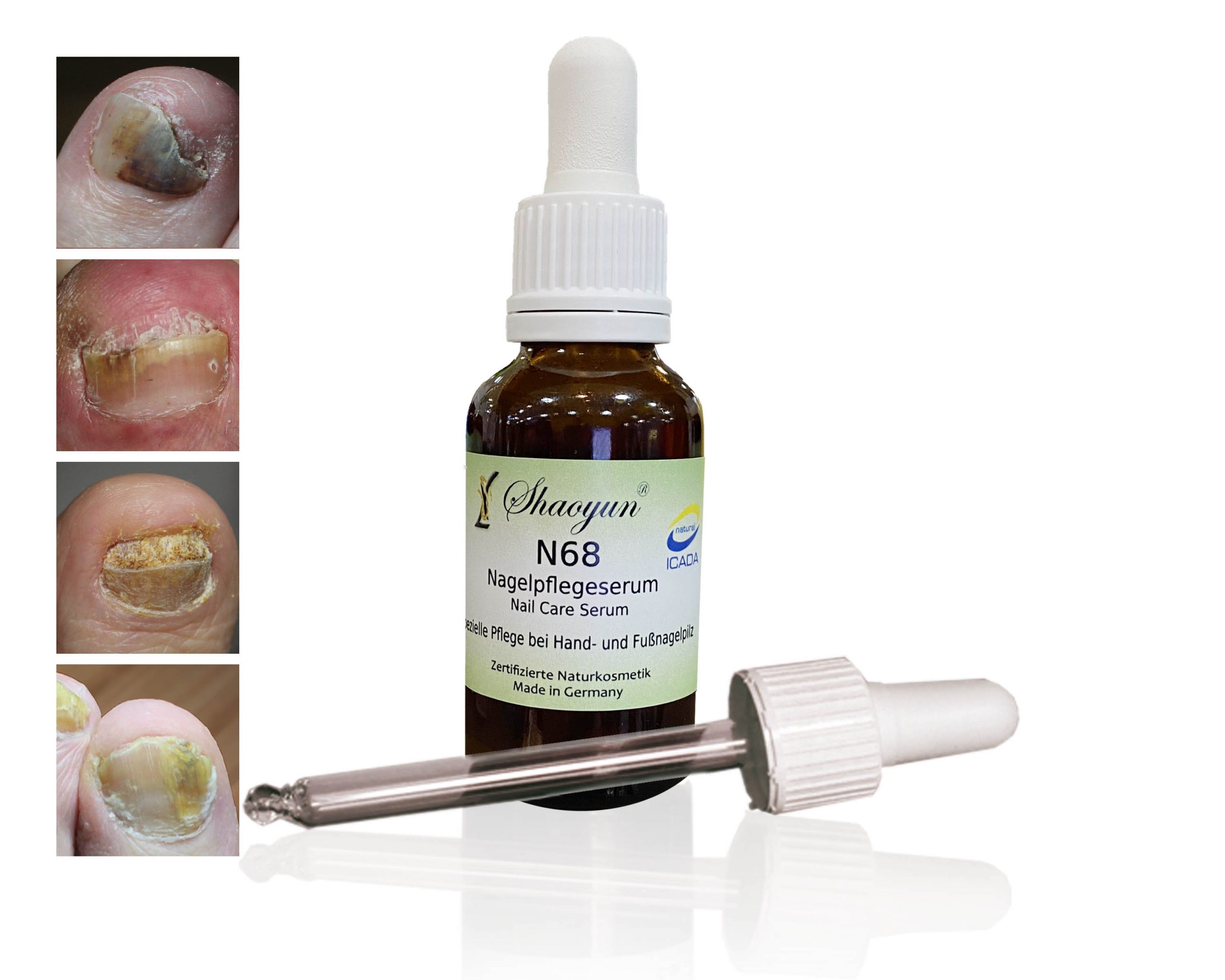Shaoyun N68 Nagelpflegeserum bei Nagelpilz Kräuter Bio-Öl